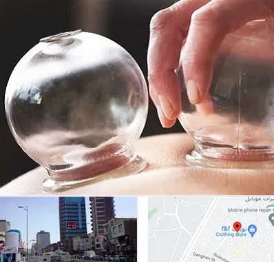 مرکز حجامت در چهارراه طالقانی کرج