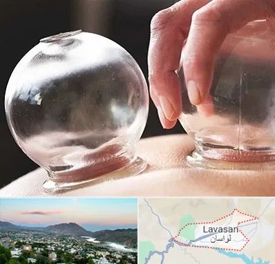 مرکز حجامت در لواسان