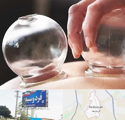 مرکز حجامت در فردوسیه شهریار