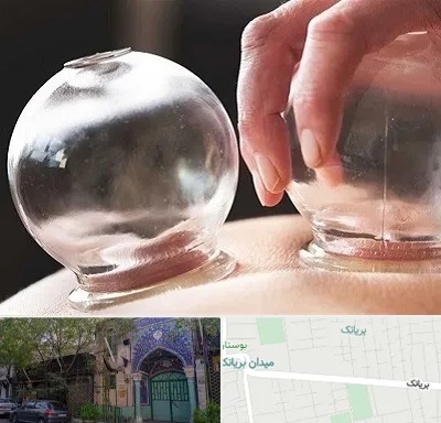 مرکز حجامت در بریانک