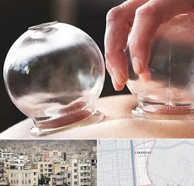 مرکز حجامت در اسکندری