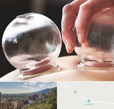 مرکز حجامت در بوکان تهران