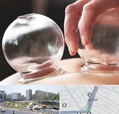 مرکز حجامت در هفت تیر