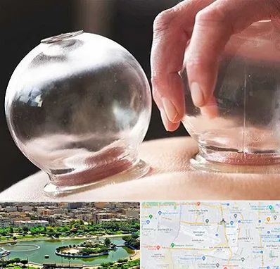 مرکز حجامت در منطقه 9 تهران