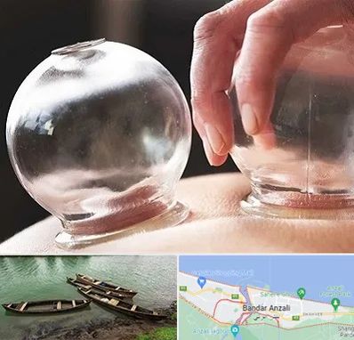 مرکز حجامت در بندر انزلی