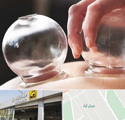 مرکز حجامت در عبدل آباد