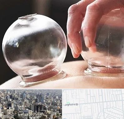 مرکز حجامت در جیحون