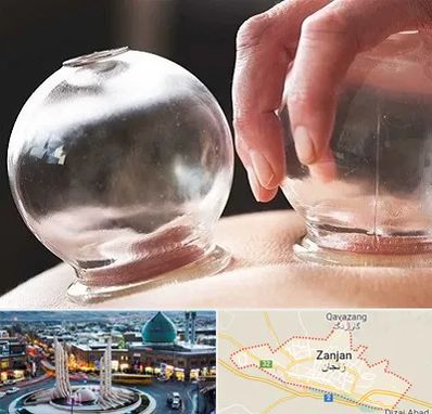 مرکز حجامت در زنجان