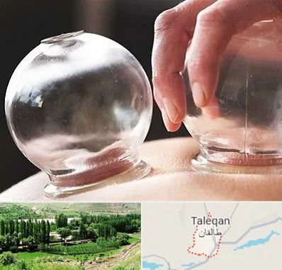 مرکز حجامت در طالقان