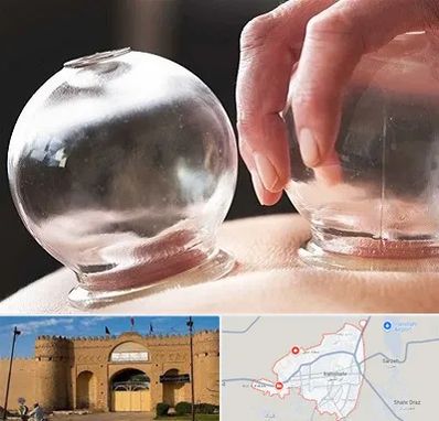 مرکز حجامت در ایرانشهر