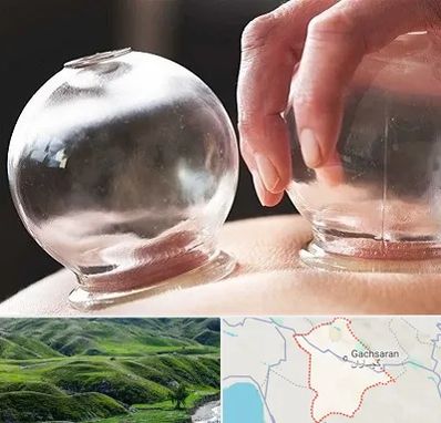 مرکز حجامت در گچساران