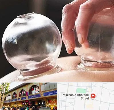 مرکز حجامت در 15 خرداد