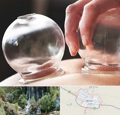 مرکز حجامت در شیروان
