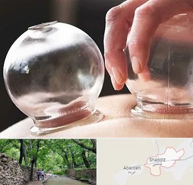 مرکز حجامت در شاندیز مشهد