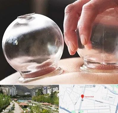 مرکز حجامت در بلوار تعاون