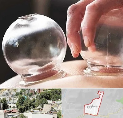 مرکز حجامت در جماران