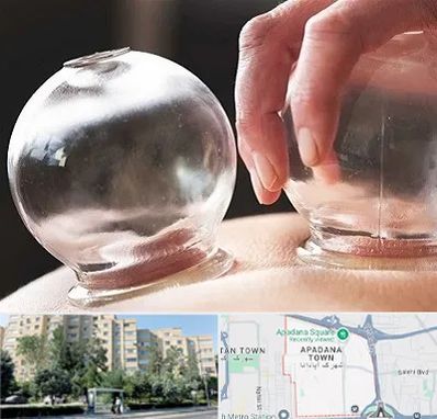 مرکز حجامت در آپادانا