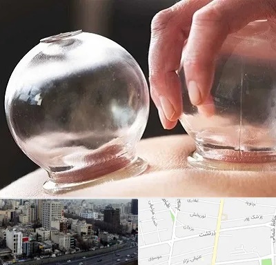 مرکز حجامت در زرتشت
