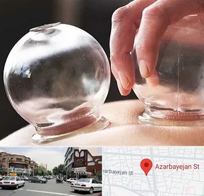 مرکز حجامت در خیابان آذربایجان