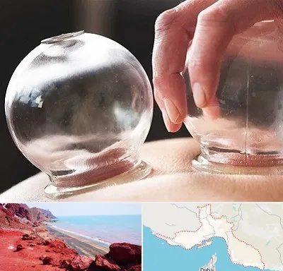 مرکز حجامت در هرمزگان