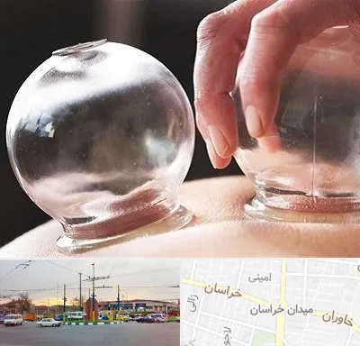 مرکز حجامت در میدان خراسان
