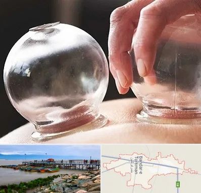مرکز حجامت در بندر ترکمن