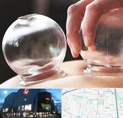 مرکز حجامت در بلوار اباذر