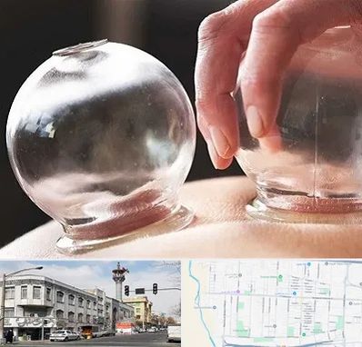 مرکز حجامت در 17شهریور