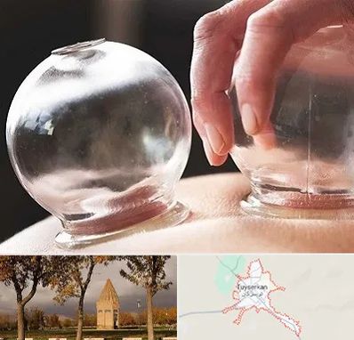 مرکز حجامت در تویسرکان