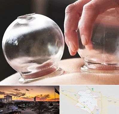 مرکز حجامت در قوچان