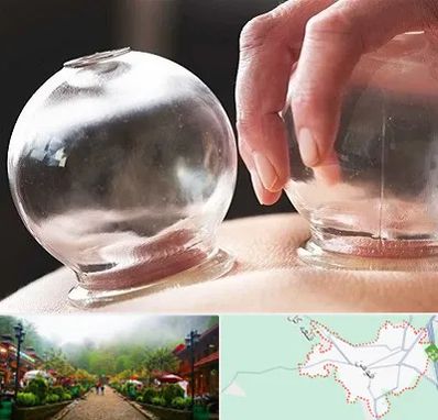 مرکز حجامت در فومن