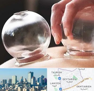 مرکز حجامت در قیطریه 