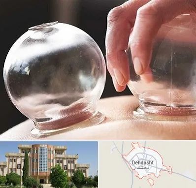 مرکز حجامت در دهدشت