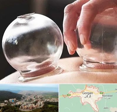 مرکز حجامت در گرگان