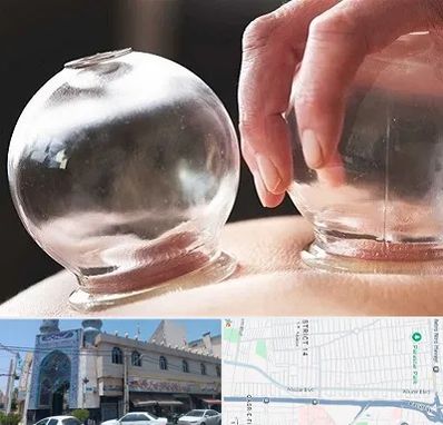 مرکز حجامت در بلوار ابوذر