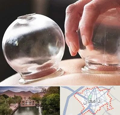 مرکز حجامت در دامغان