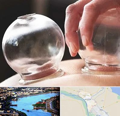 مرکز حجامت در خرمشهر