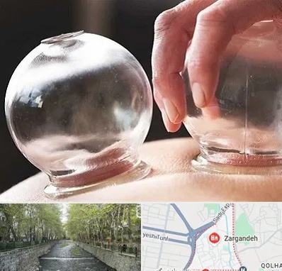 مرکز حجامت در زرگنده