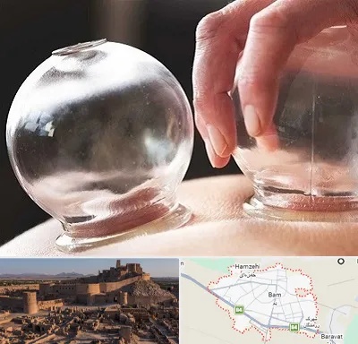 مرکز حجامت در بم