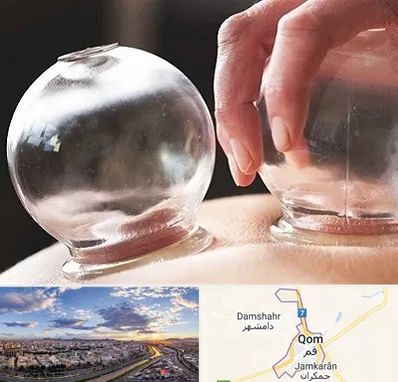 مرکز حجامت در قم