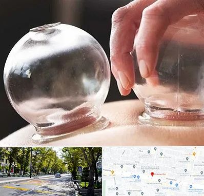 مرکز حجامت در میرداماد