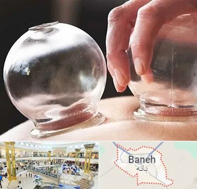 مرکز حجامت در بانه