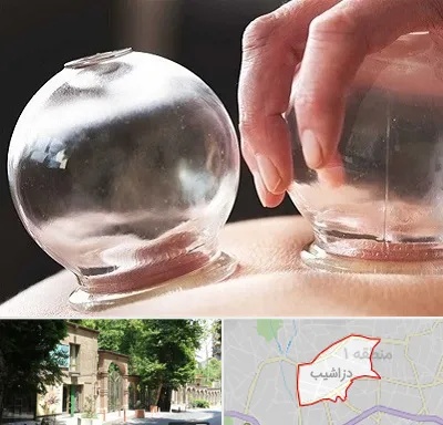 مرکز حجامت در دزاشیب