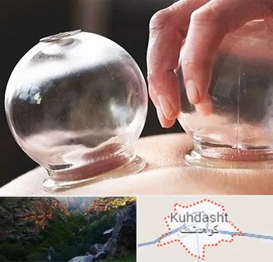 مرکز حجامت در کوهدشت