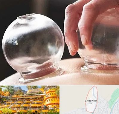 مرکز حجامت در دربند