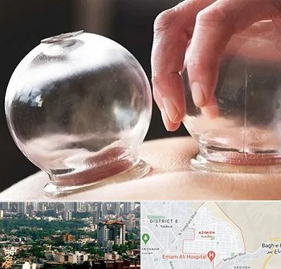 مرکز حجامت در عظیمیه کرج 