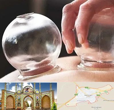 مرکز حجامت در سمنان