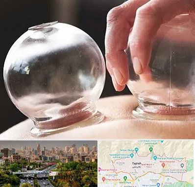 مرکز حجامت در منطقه 1 تهران