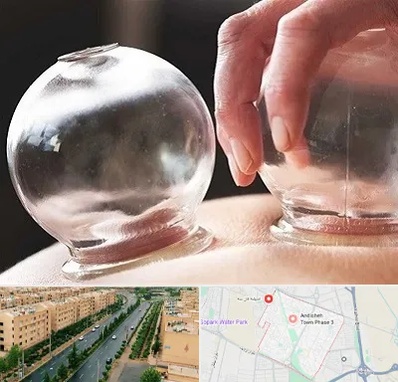 مرکز حجامت در فاز سه اندیشه