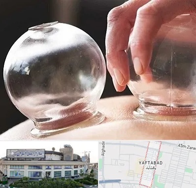 مرکز حجامت در یافت آباد